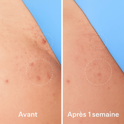 ROLL-ON ANTI POILS INCARNÉS™ barbes, visage, maillot et corps .