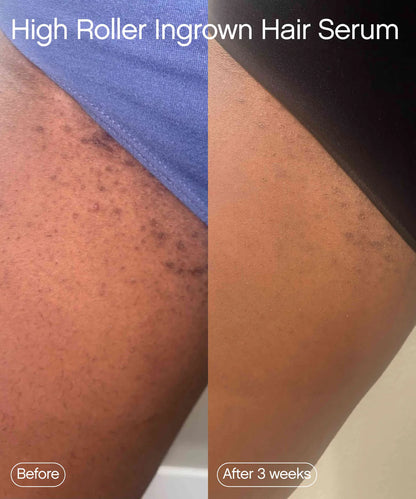 ROLL-ON ANTI POILS INCARNÉS™ barbes, visage, maillot et corps .